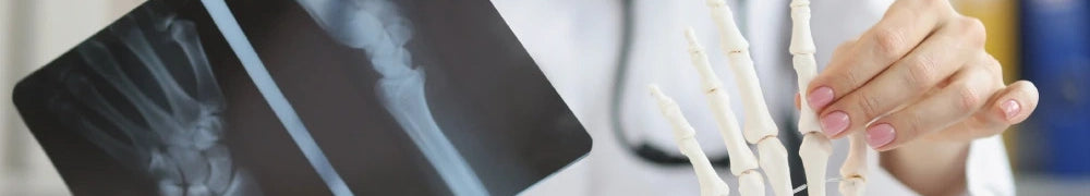 How to Prevent Osteoporosis and Promote Bone Health with Food