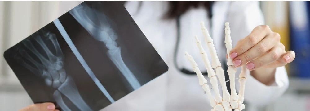 How to Prevent Osteoporosis and Promote Bone Health with Food